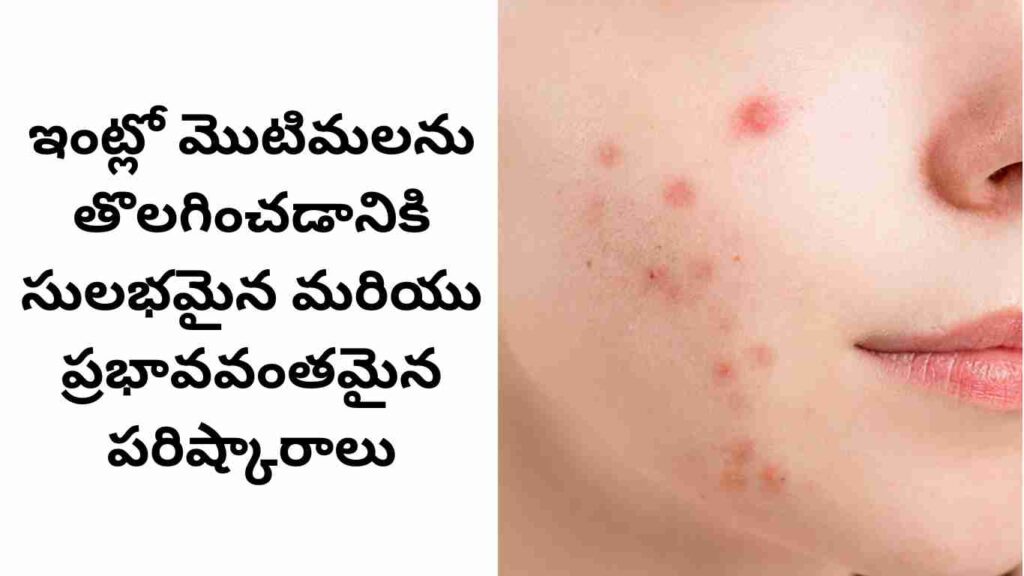 How to remove pimples at home
